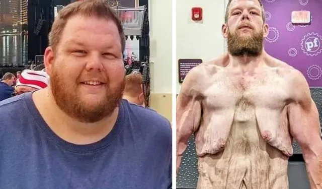 163 Kilo Verdi Ama Çilesi Bitmiyor