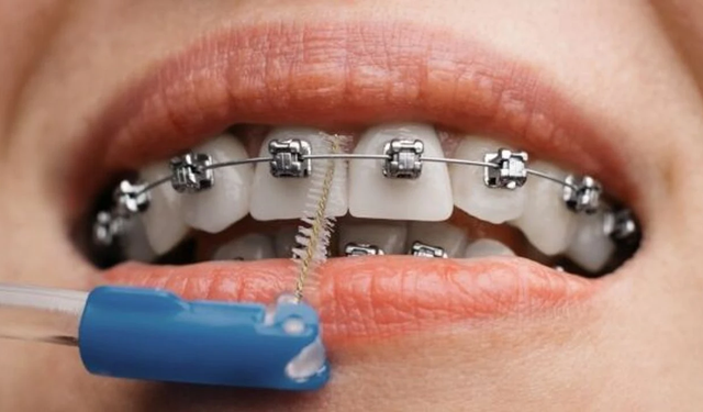 İstanbul Ağız ve Diş Sağlığı Tedavilerinde Nasıl Lider Konuma Geldi?