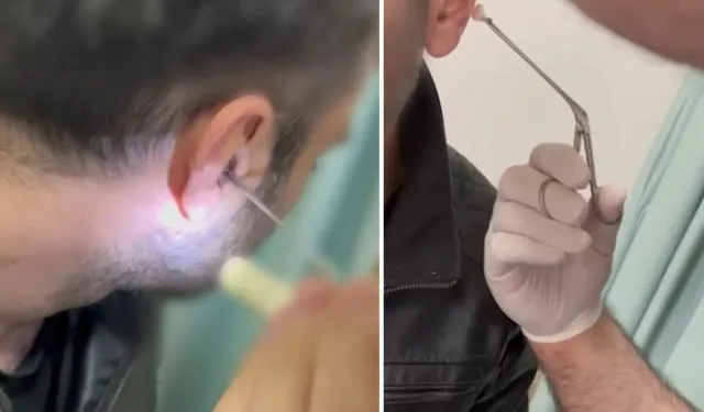 Kayseri’de Şüphelinin Kulağında Yasaklı Madde Bulundu