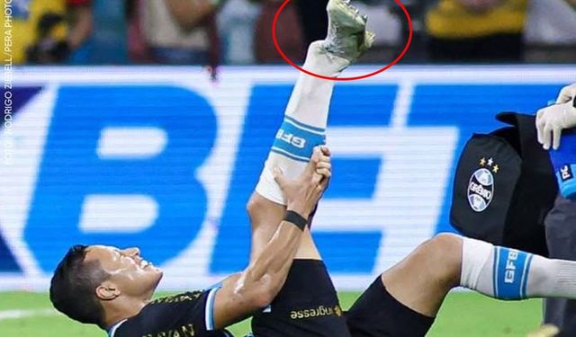 Marlon Rodrigues Maçta Ağır Sakatlık Geçirdi