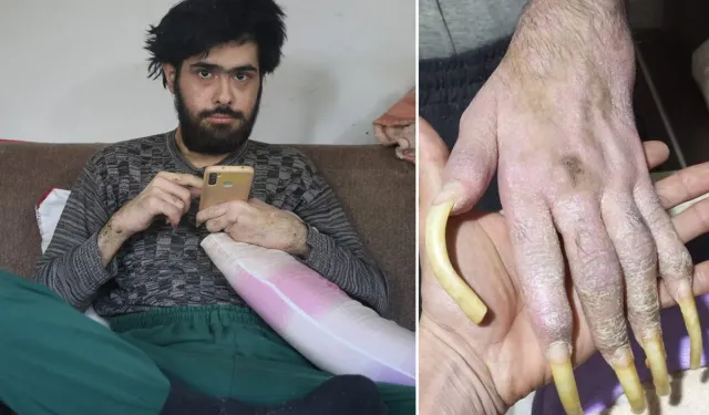 Deprem Sonrası Zor Günler Geçiren Barışa Sürpriz