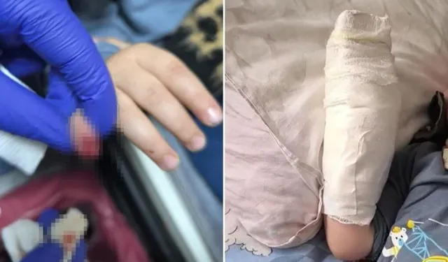 Mardin’de AVM’de Çocuğun Parmağı Koptu