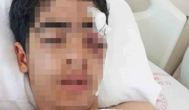 Esenyurt’ta Akran Zorbalığı Çocuğu Yaraladı