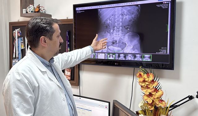 Erzurum’da 51 Taşla Şaşırtan Ameliyat