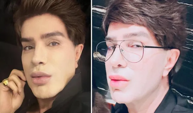 Yılmaz Morgül’den Yıldız Tilbe Açıklaması