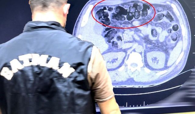 Batman'da Şüpheli Yolcunun Midesinden Yasaklı Madde Çıktı