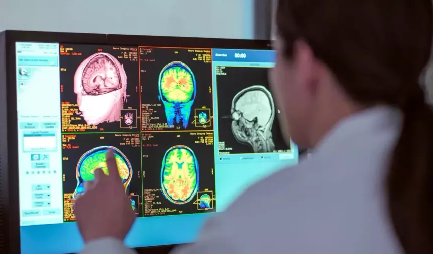 Beyin Yaşam Boyunca Beş Büyük Evrim Aşaması Geçiriyor