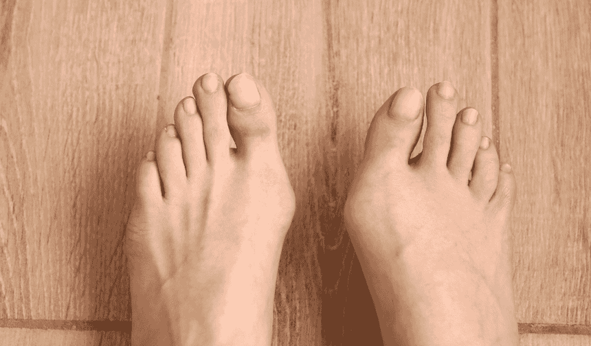 Halluks Valgus Gece Ateli: Gerçekten İşe Yarıyor mu, Yoksa Vakit Kaybı mı?