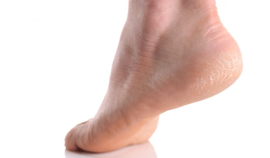 Nasır Neden Oluşur ve Belirtileri Nelerdir?