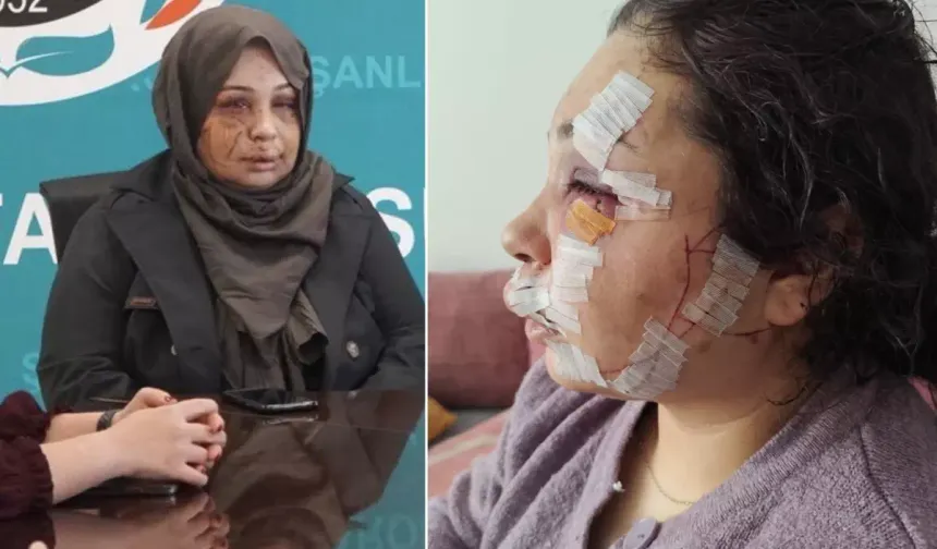 Eşine Şiddet Uygulayan Koruma Polisi Tutuklandı