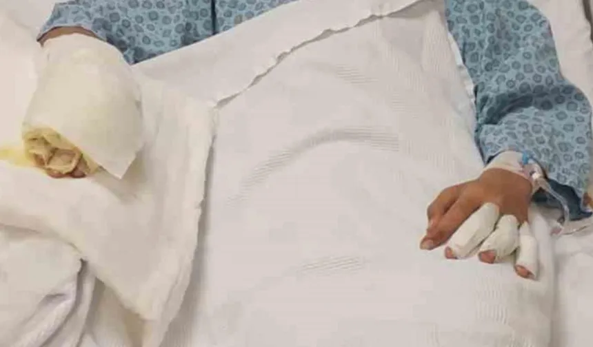 Araklı’da Benzinle Alevlenen Ateş Yaralanmaya Neden Oldu