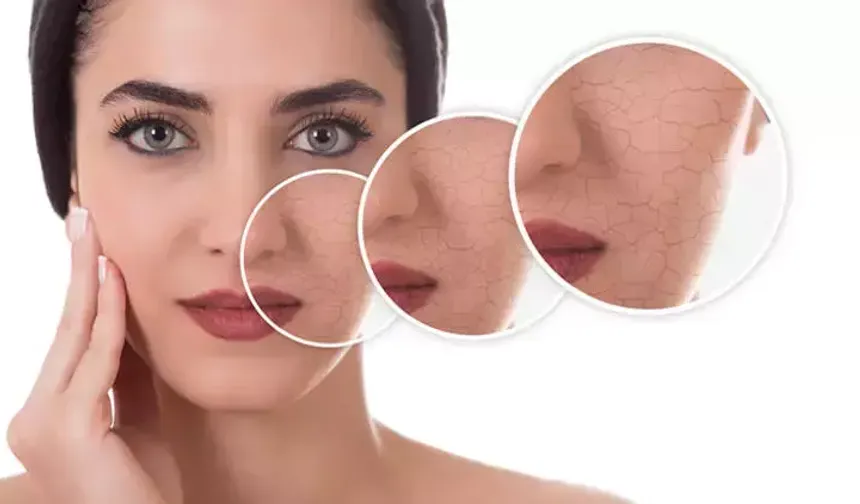 Stres Cildi Nasıl Etkiler Bilimsel Açıklandı