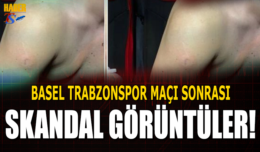 Basel'de Trabzonspor Taraftarına Plastik Mermi Sıktılar!