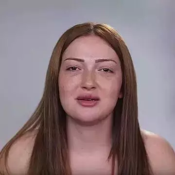 Danla Bilic Ten Buyuk Donusum Estetik Icin Adeta 18739015 4177 M.jpg