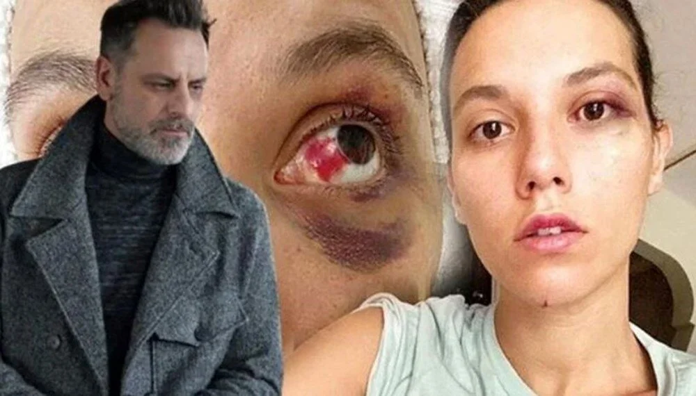 Mj4Rm Nj6D Ee S Yux T Xhd W D Q.jpg