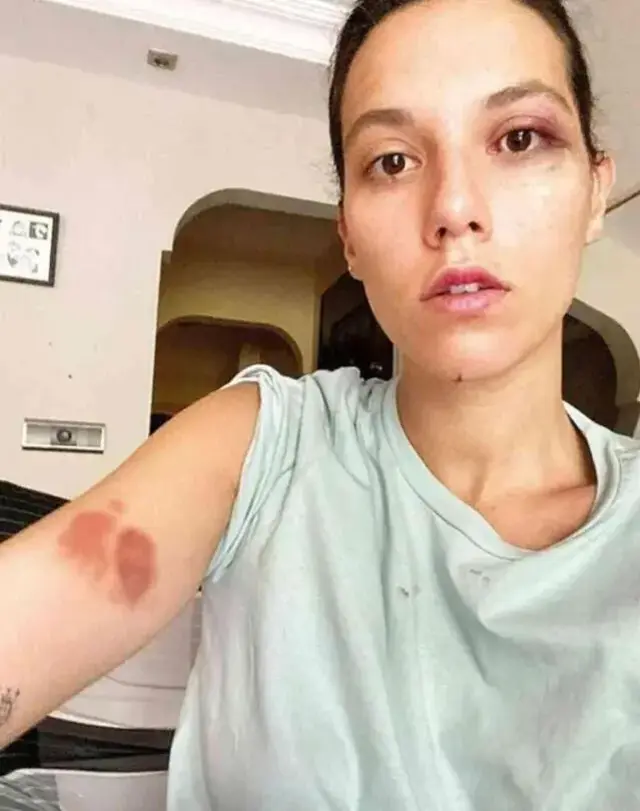 Ozan Guven E Kasten Yaralama Sucundan Hapis 18741263 6539 M.jpg