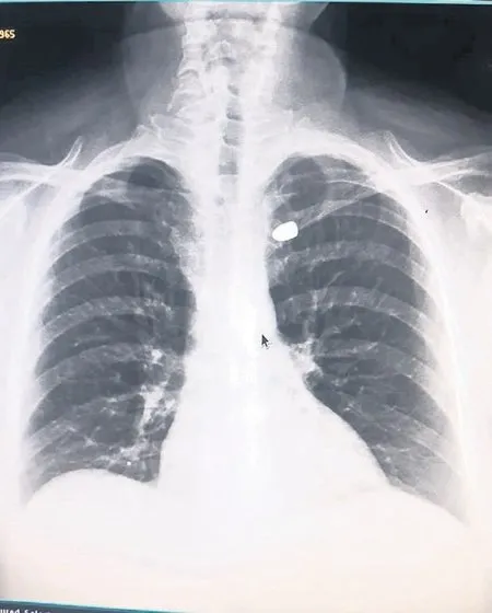 0X0 Yine Yorgun Mermi Kabusu 1751493264096