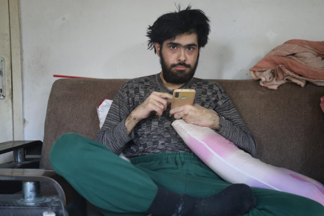 3 Yil Sonra Dus Alip Tiras Olan Baris In 19184298 3011 M