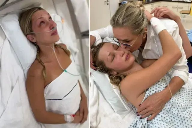 Bella Hadid Ten Ruh Sagligi Itirafi Bu Bir 19145103 5094 M