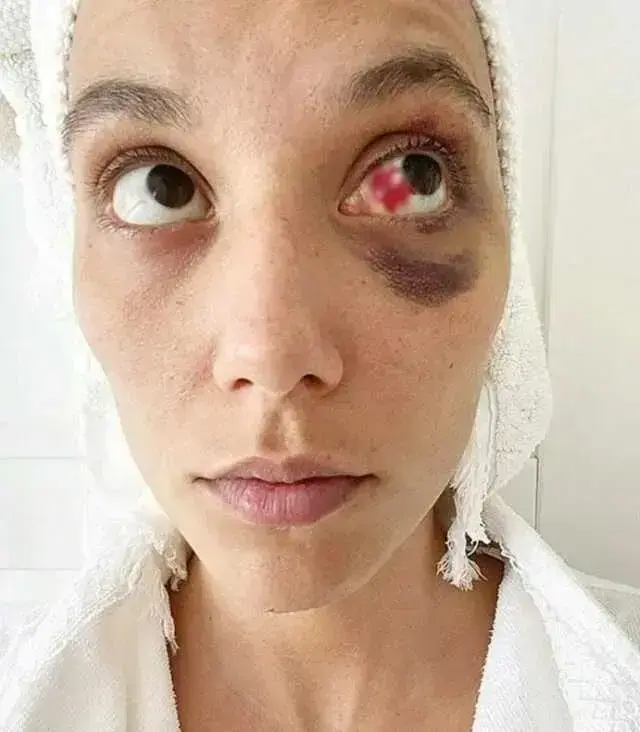 Ozan Guven In Hapis Cezasi Kesinlesti 19176298 2152 M