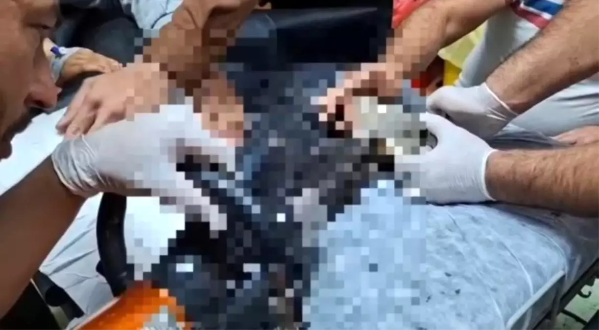 Tel Abyad Ta Elini Kiyma Makinesine Kaptiran 19183667 Amp