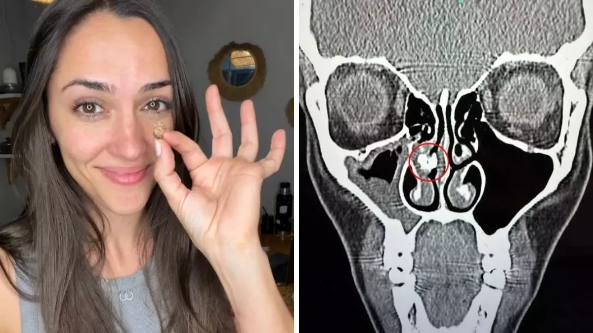 35 Yil Sonra Ortaya Cikan Gercek Burnundan Cikan 19302457 8108 Amp