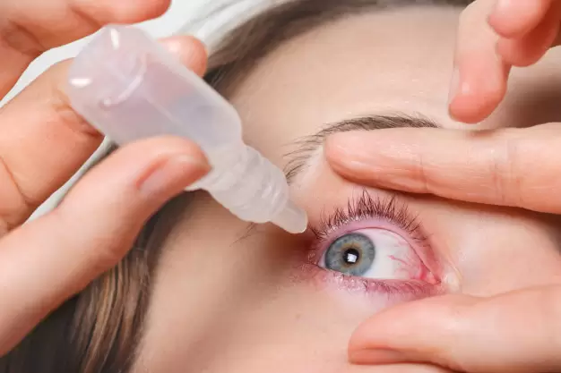 Close Up Female Pours Drops Red Eye Has Conjuctivitis Glaucoma Bad Eyesight Pain Eyes Pain Treatment Concept Woman Cures Red Blood Eye 176532 8745.Jpg