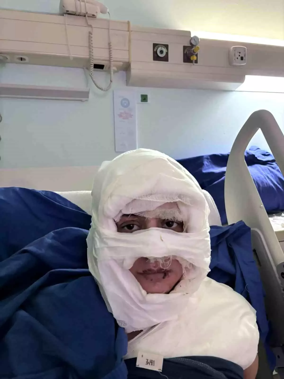 Kadikoy De Akil Almaz Olay Genc Kadin Baska B 19236288 Amp