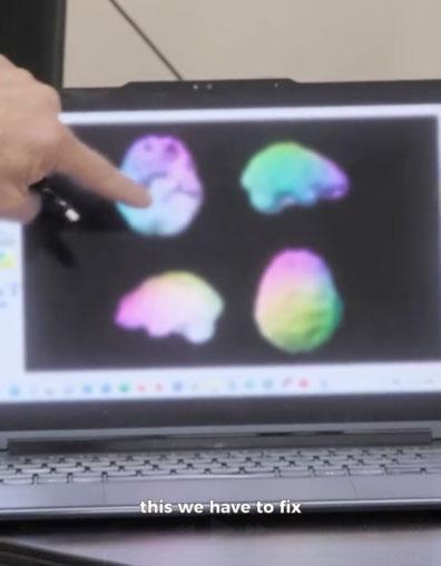 Kim Kardashian In Beyin Taramasindan Dusuk 19306427 6168 M