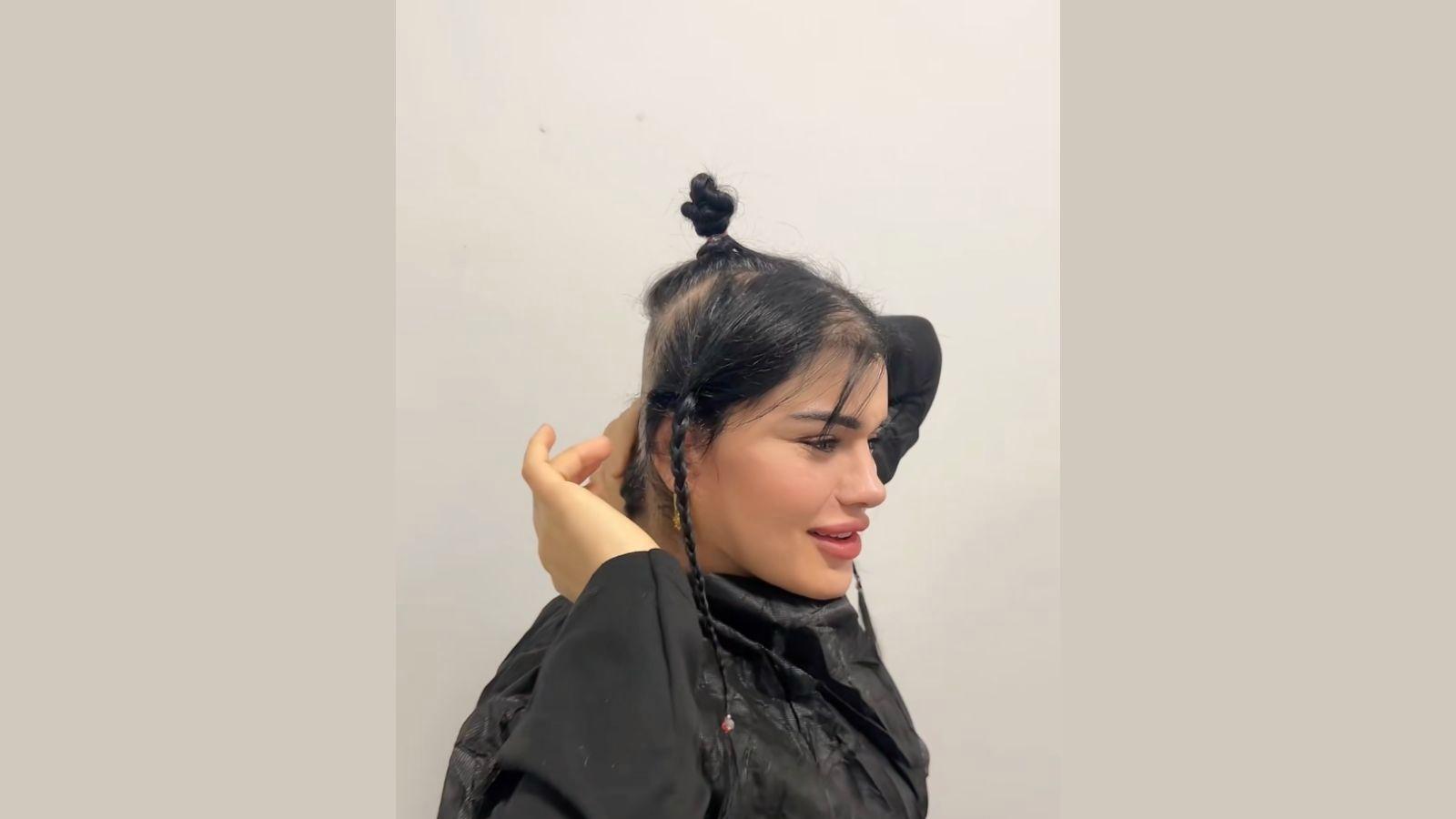 Tiktok Fenomeni Hulya Mizginin Saclari Estetik Kurbani 3 Sap4P E F