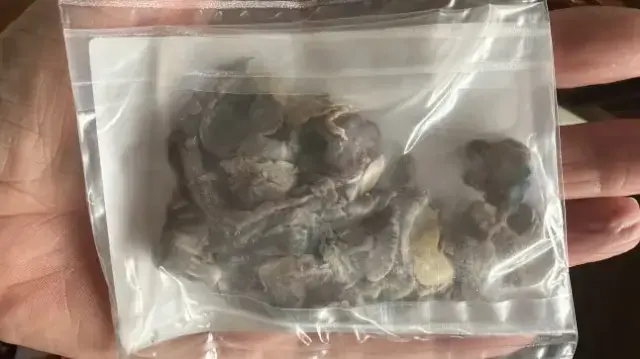 Daha 17 Yasinda Hastaneye Zor Yetistirdiler 19313727 4001 M