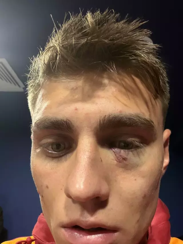 Derbi Sonrasi Men Karari 19313205 5038 M