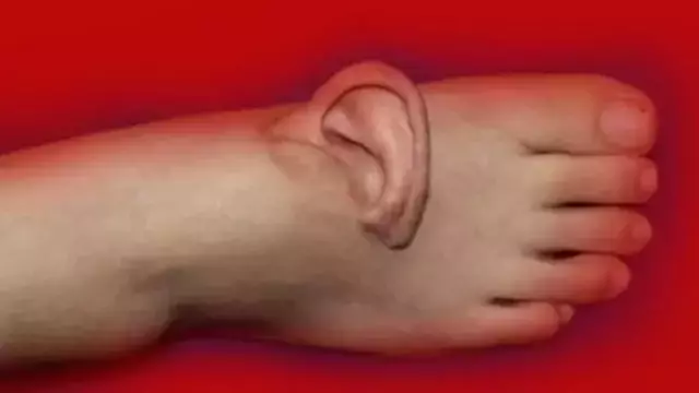 Esi Benzeri Olmayan Olay Kulagini 5 Ay Ayaginda 19346627 4542 M