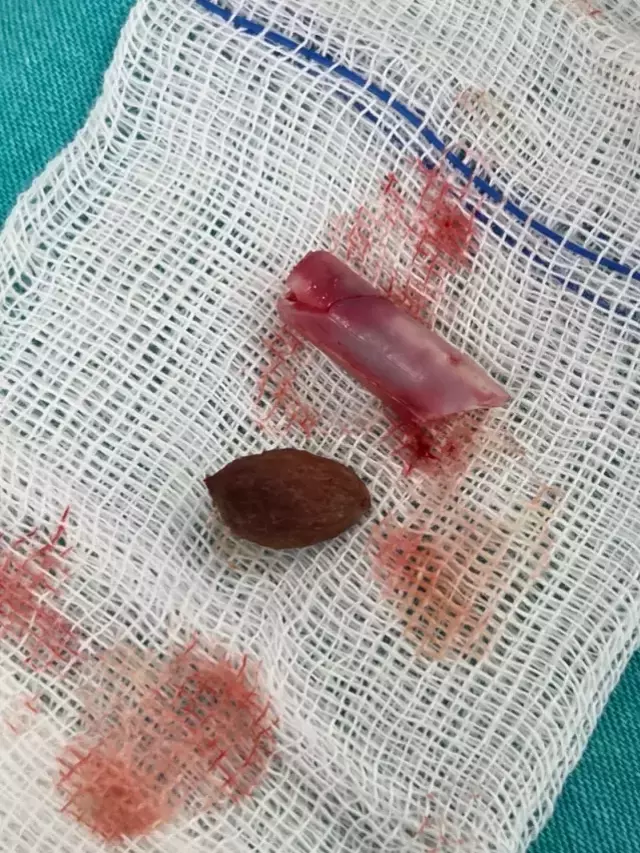 Kasinti Sikayetiyle Hastaneye Giden Emirhan I 2 19396499 O