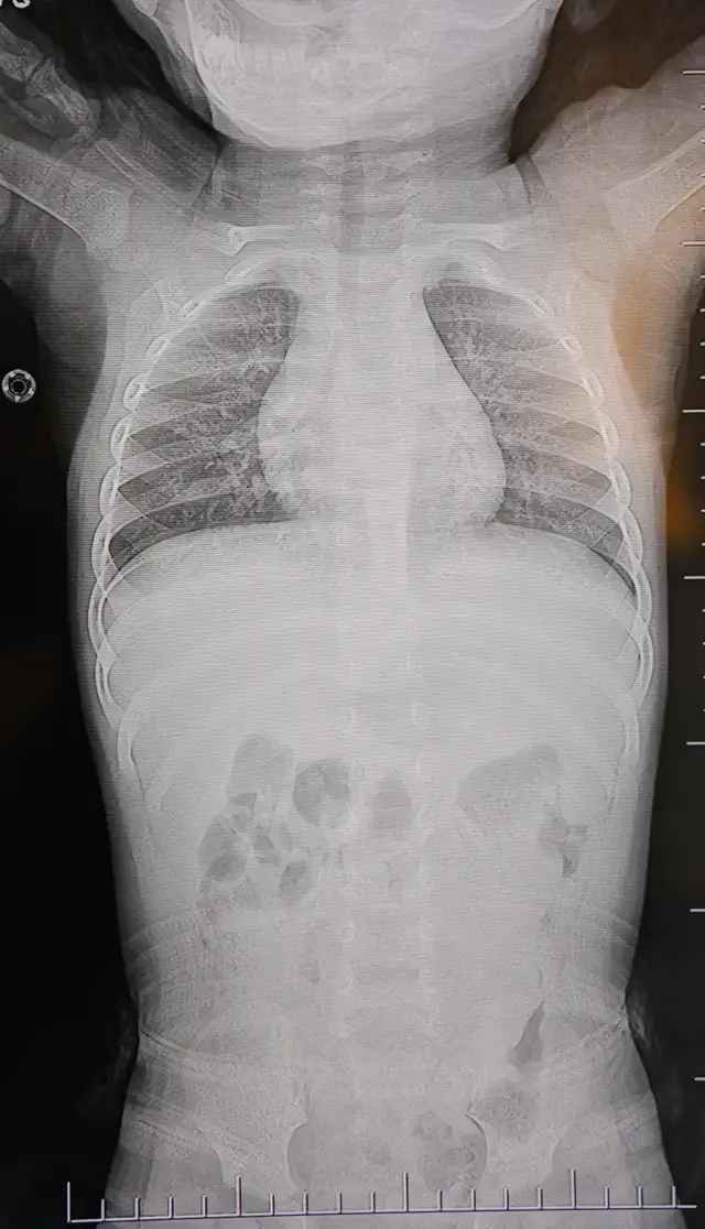 1 Yasindaki Bebek Sirtustu Yatirildikca Agladi 19517959 8611 M