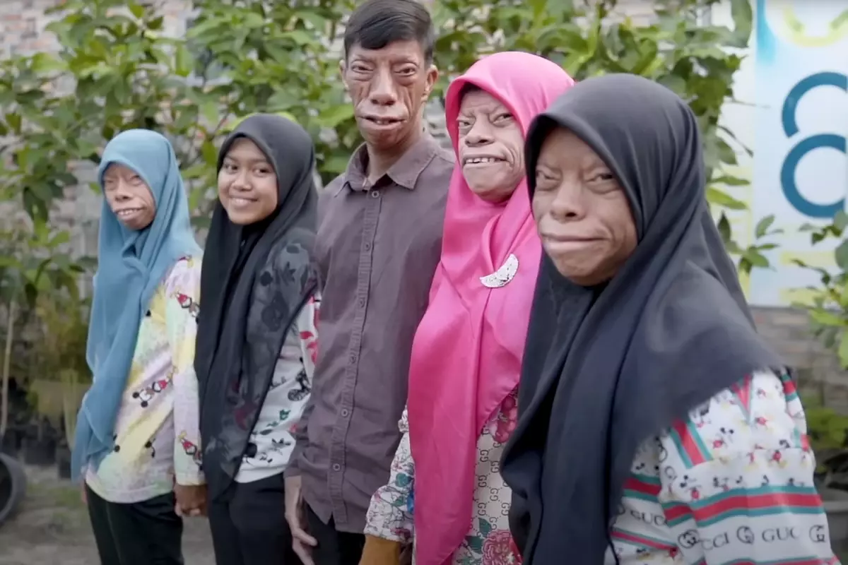 Dunya Onlari Konusuyor Kertenkele Ailesi Kisa 19479317 2194 Amp