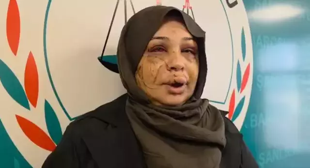 Esini Bu Hale Getiren Cumhurbaskani Koruma 19474012 2483 M