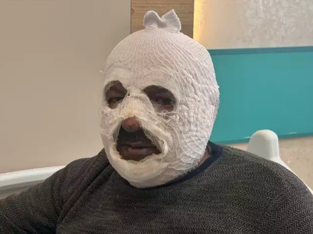 Kalorifer Kazanini Yakmak Icin Doktugu Benzin Az 19446512 3272 M