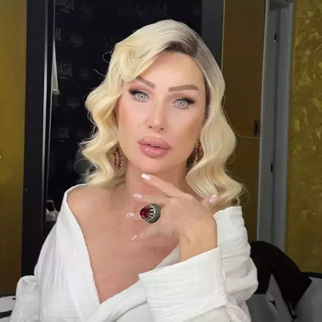 Seda Sayan In Yuzundeki Sisligin Nedeni Ortaya 19433731 9875 M