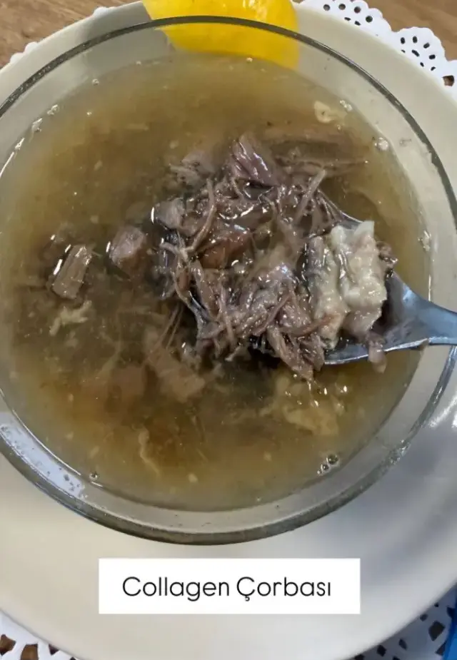 Seyma Subasi Nin Kelle Paca Corbasina Verdigi 19552798 4644 M