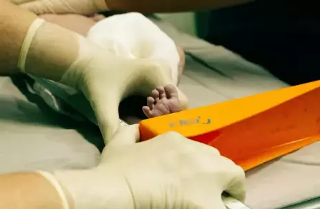 Vakalar Kisin Pik Yapiyor Her Yil 30 Milyondan 19561391 9922 M