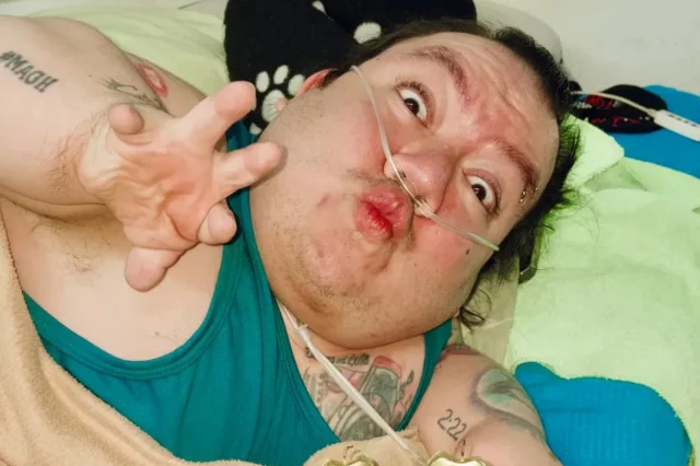 Cuce Fenomen Alejo Little Hayatini Kaybetti Son 19666793 4372 M