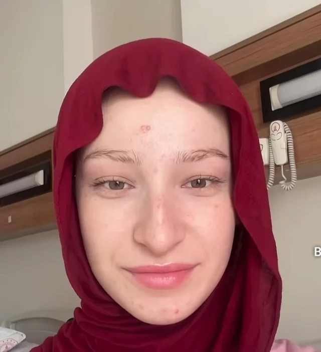 Fatma Soydasin Estetiksiz Hali 7C1845A354 2209 2 M