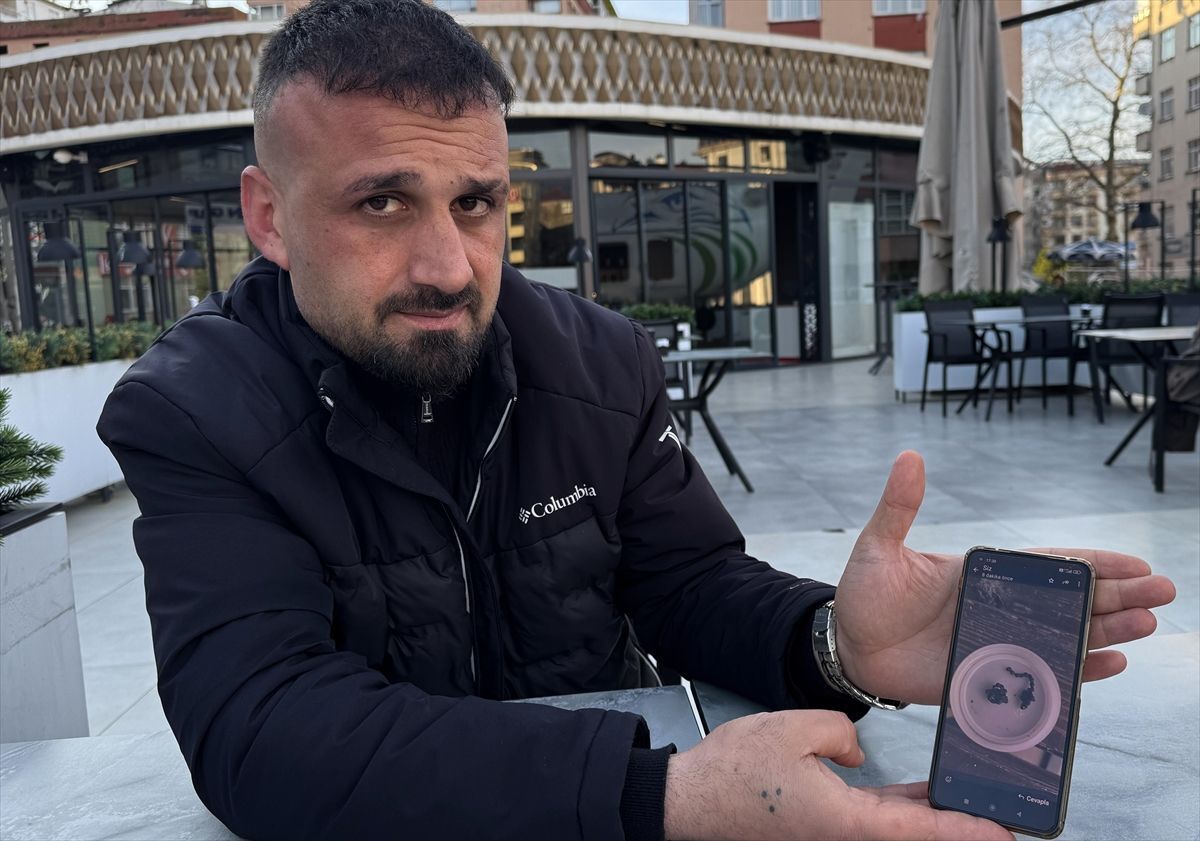 Rize De Burnundan Zincir Parcasi Cikarilan Co 19696170 Amp