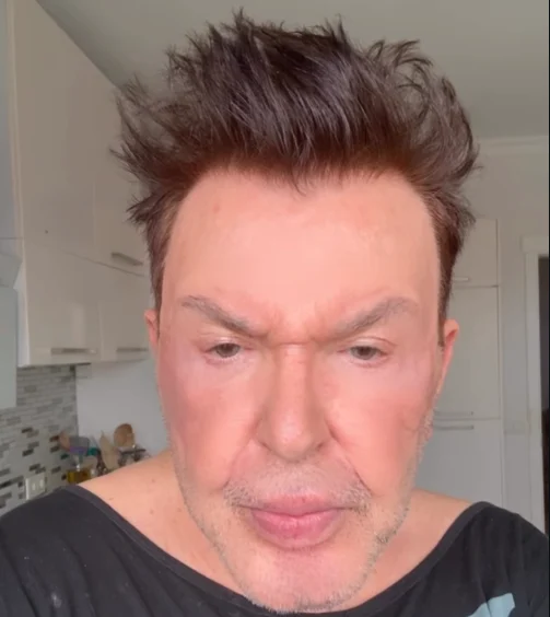 Yuzunu Gerdiren Kusum Aydin In Son Hali Ortaya 19700708 5362 M