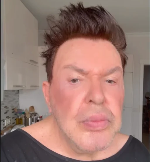 Yuzunu Gerdiren Kusum Aydin In Son Hali Ortaya 19700708 7318 M