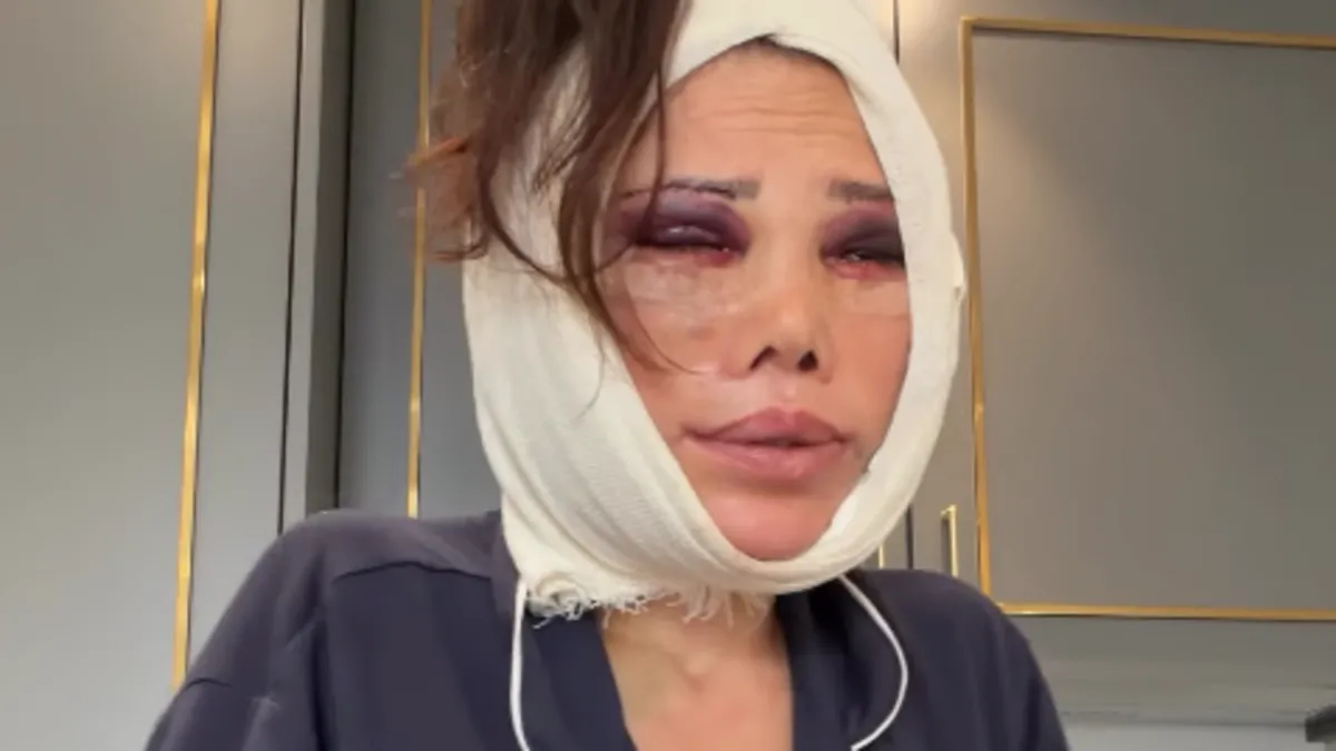 1200X675 Eski Survivor Yarismacisi Didem Ceran Gozyaslarina Boguldu Ikinci Yuz Nakli Ameliyati Sonrasi Isyan Etti Hakki 1783859119984